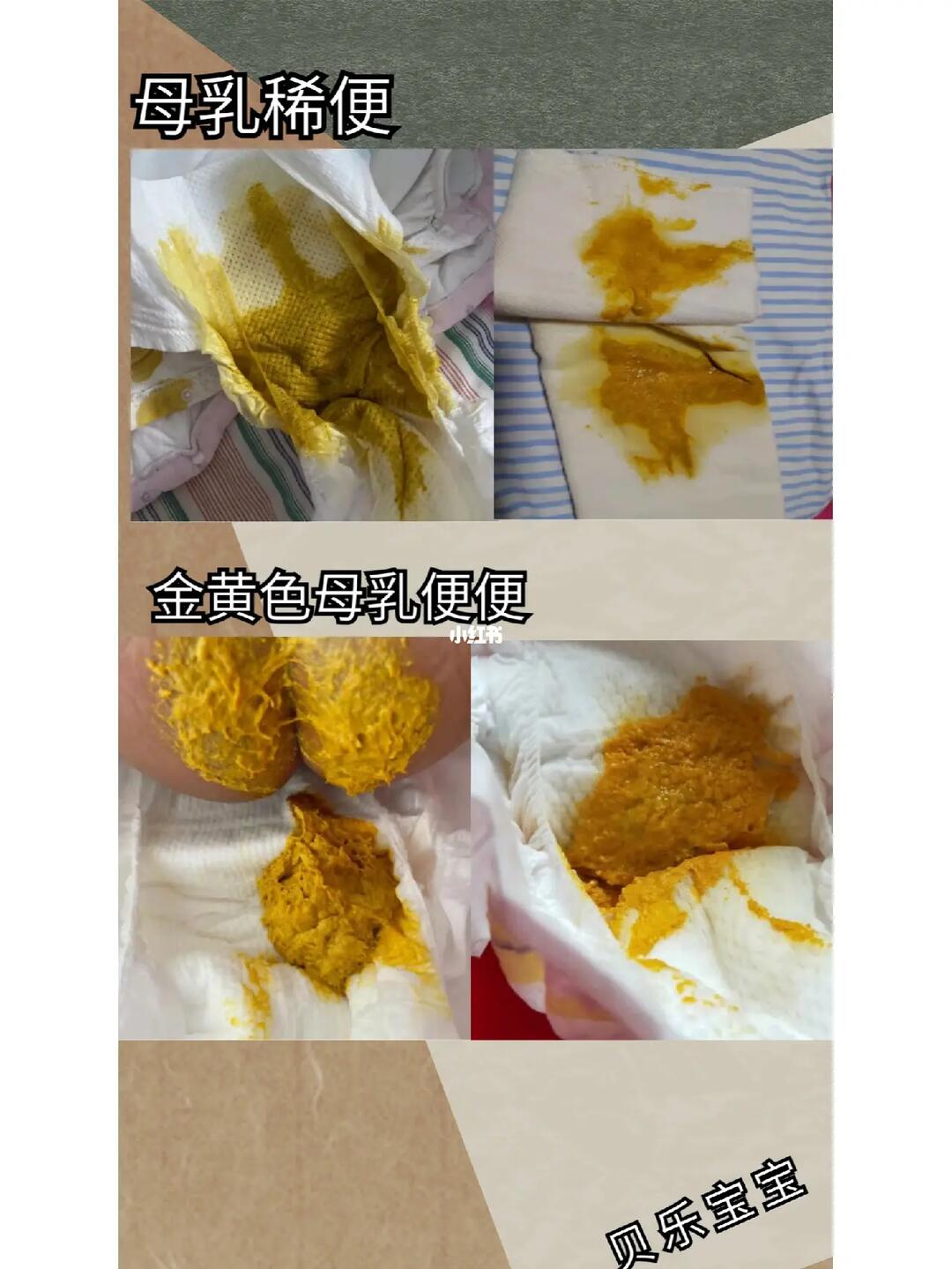 母乳喂养的宝宝便便特点