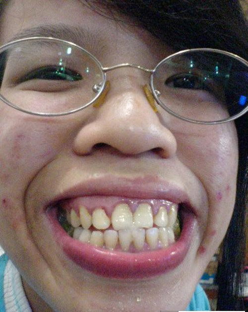 丑到你想吐!网络丑女排行榜top20 凤姐名列第六