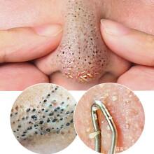 男士脸上毛孔堵塞如何是好?怎样疏通呢?