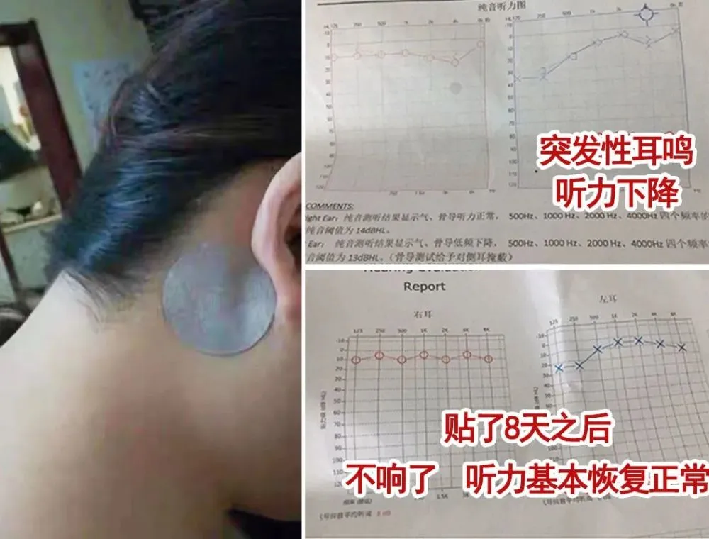 世界艾乡资讯-耳鸣不要慌,每天按几下这个穴位,疏通耳窍,耳朵终于清净