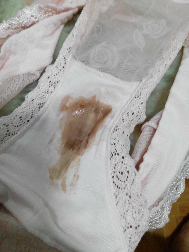 月经来完第11天,这几天下面总是流出一些棕色的分泌物,有时候是液态