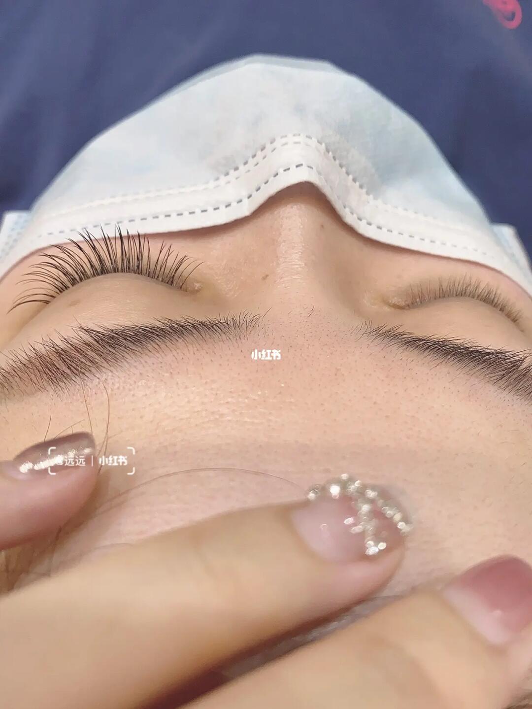 单根飞扬嫁接单根睫毛