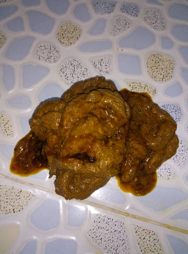 每天早上起来肚子呼噜响然后放屁然后拉稀,求帮忙看一下我拉的大便图