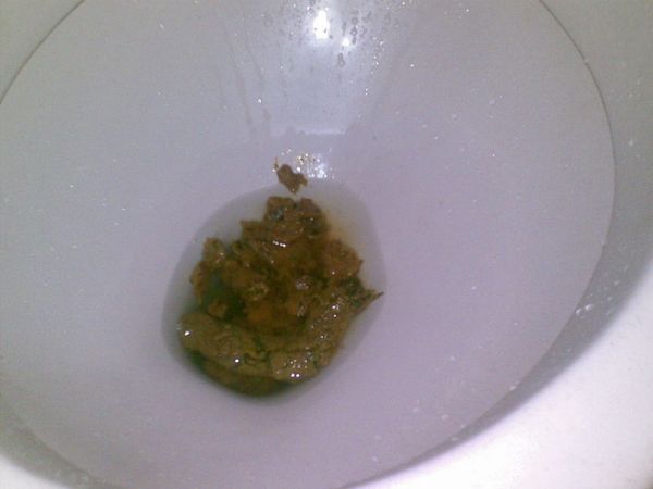 我5岁表妹在我家大便,结果她拉的屎在马桶里冲水冲不下去,怎么办?