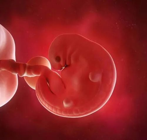 同卵双胞胎|孕囊|怀孕