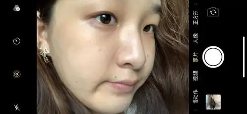 肤色严重不均怎么办啊啊啊啊