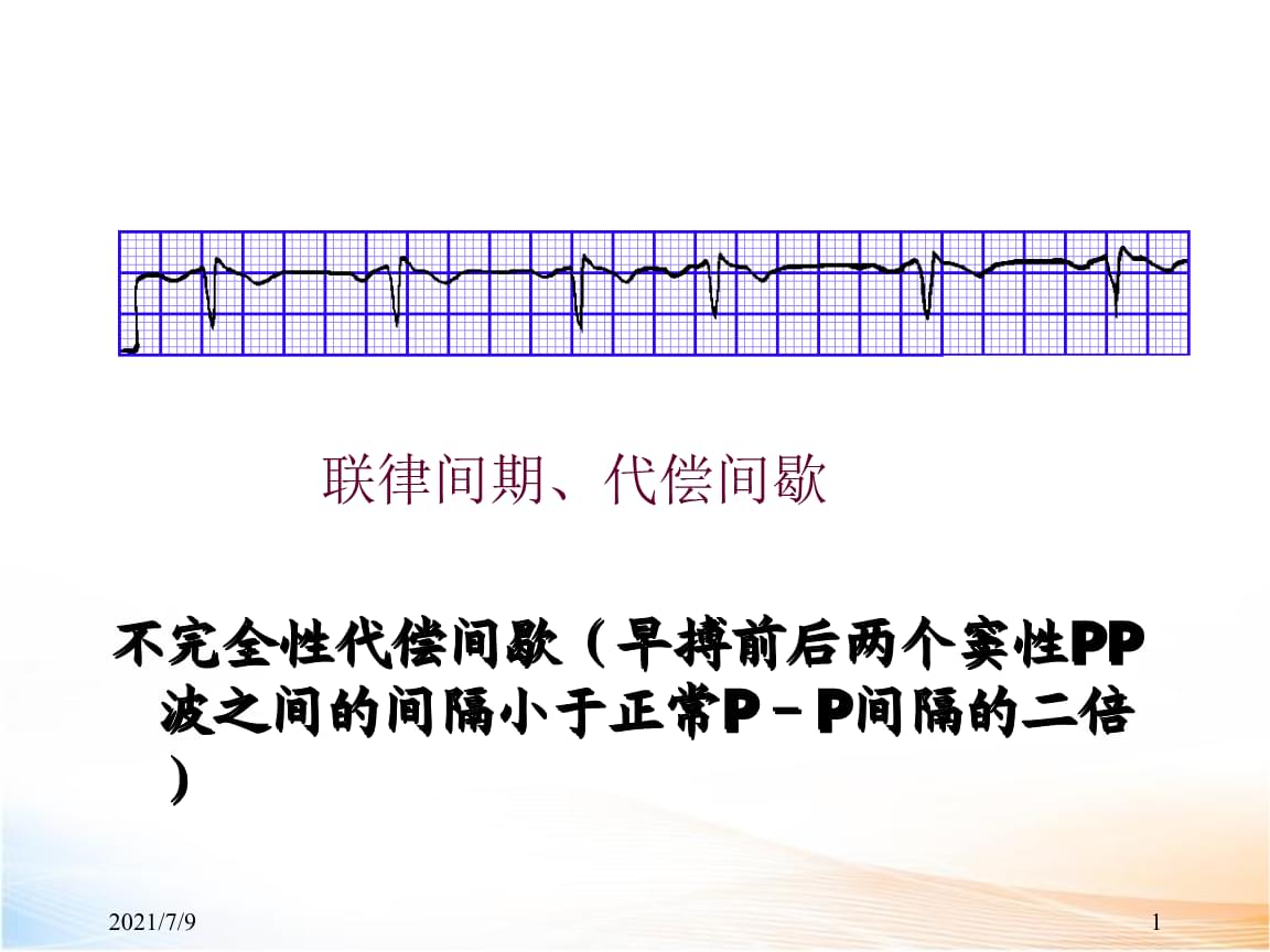 心电图教学课件.ppt 16页