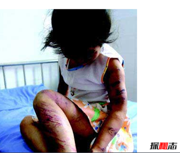 小苏丽验尸照片(死后遭亲生母亲扒坟)