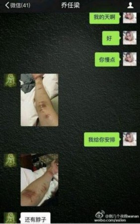 乔任梁生前最后综艺脖子上有明显伤痕