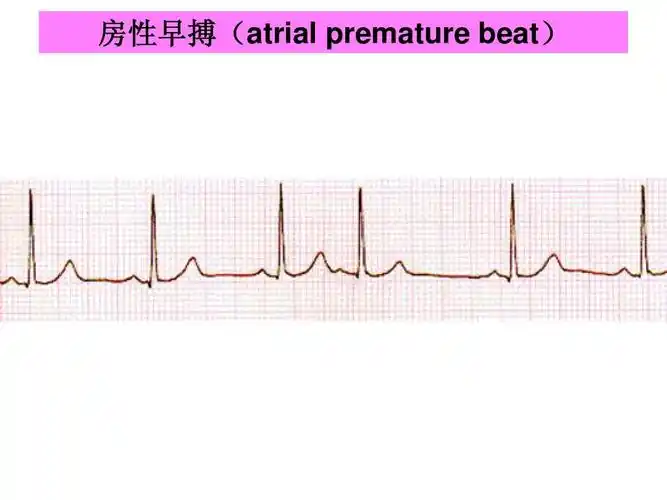 所有分类 医药卫生 临床医学 心律失常1ppt 第9页 (共63页,当前第9页)