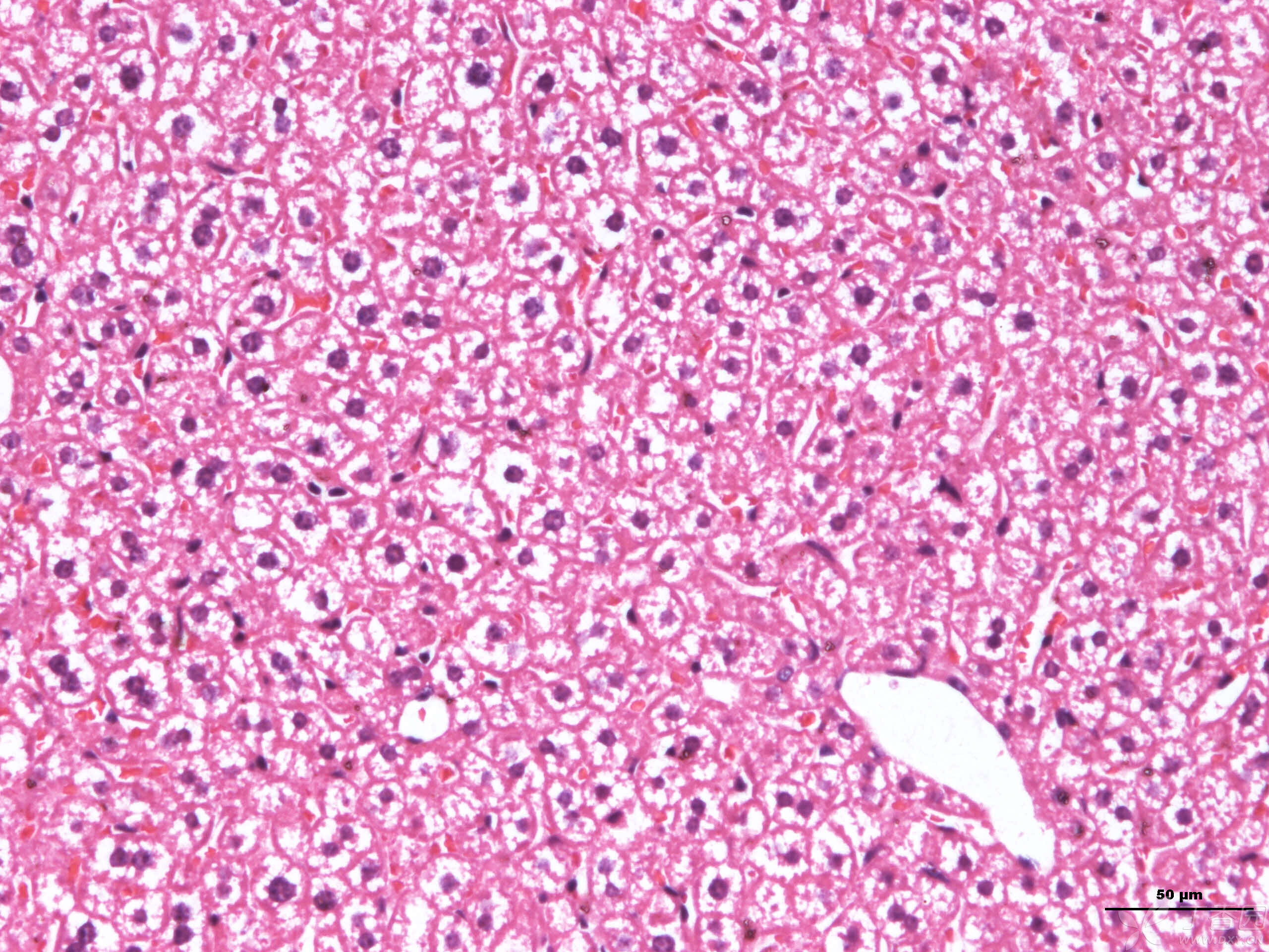 小鼠肝h&e染色图片,这些白色是脂肪变性或细胞肿胀吗?