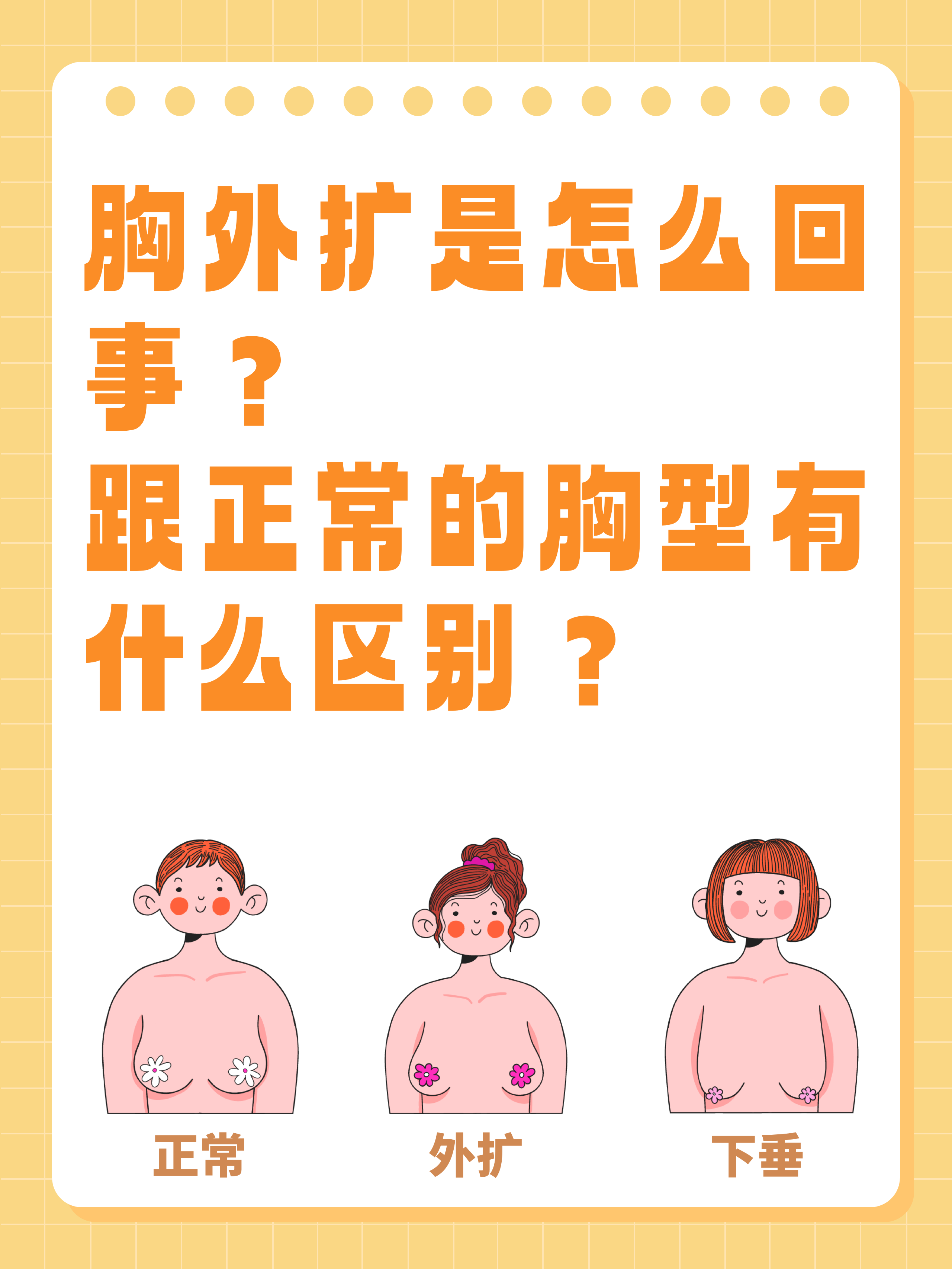 胸外扩是怎么回事?跟正常的胸型到底有什么区别?  🌿实际上,这是乳