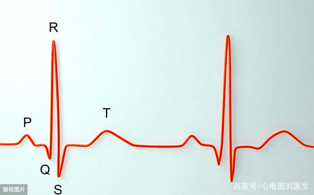典型心电图阅读与解析:左心室肥厚