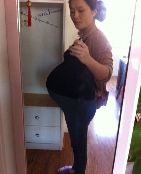 刚生下三胞胎, 妈妈就心碎了: 宝宝转眼只剩一个了