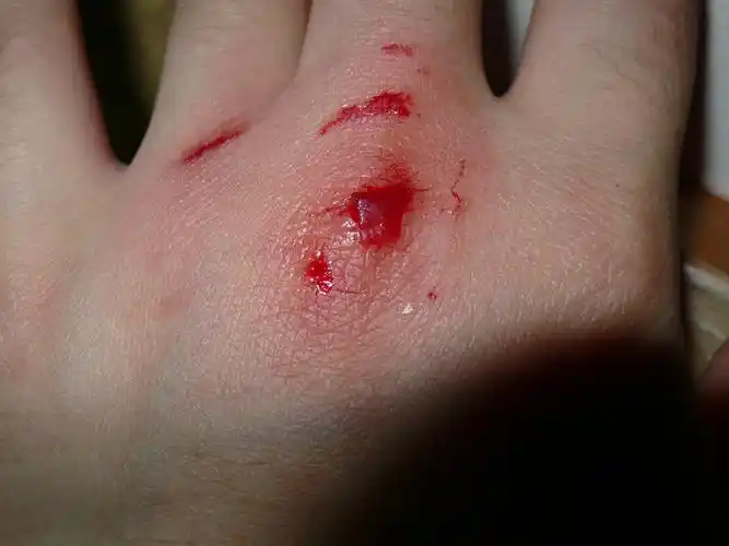 我捻我开始变态.