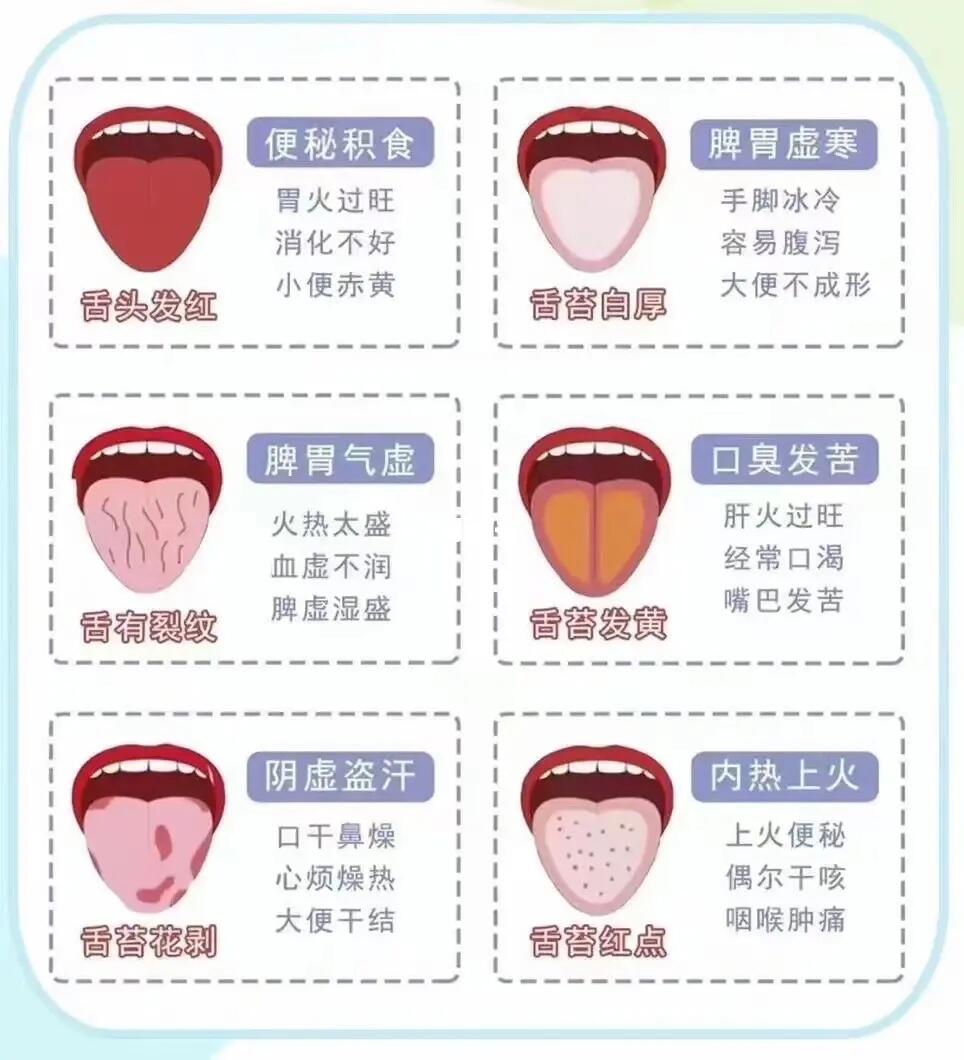 看舌像知健康舌诊入门歌人人会就这么简单