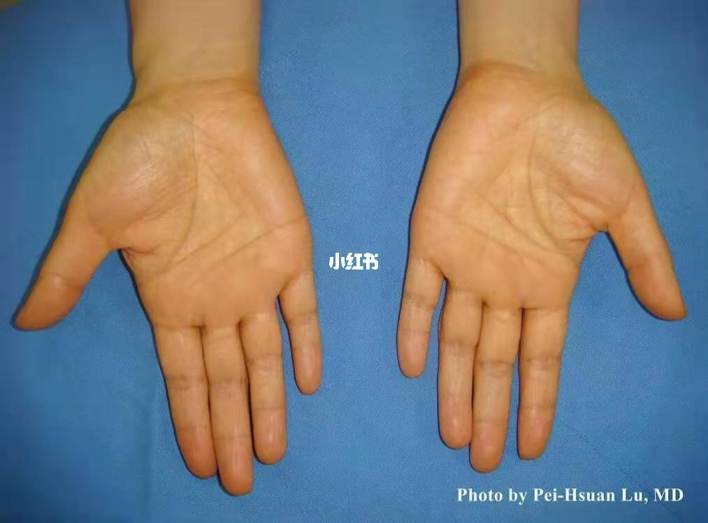 胡萝卜素_黄疸_橙子_内分泌_防晒_保湿护肤_美妆_护肤