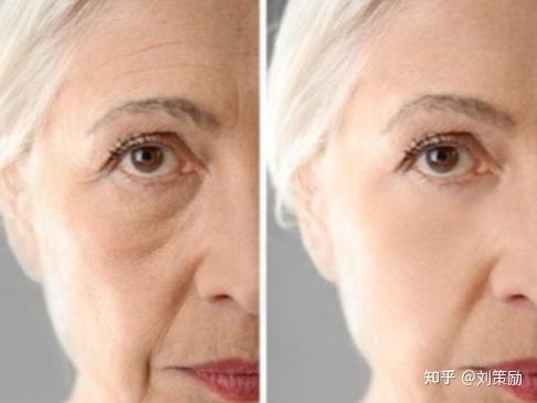 面部衰老的三个阶段