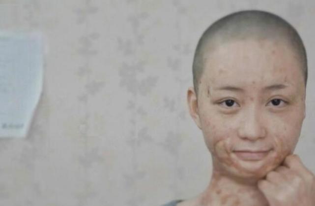 腾讯内容开放平台