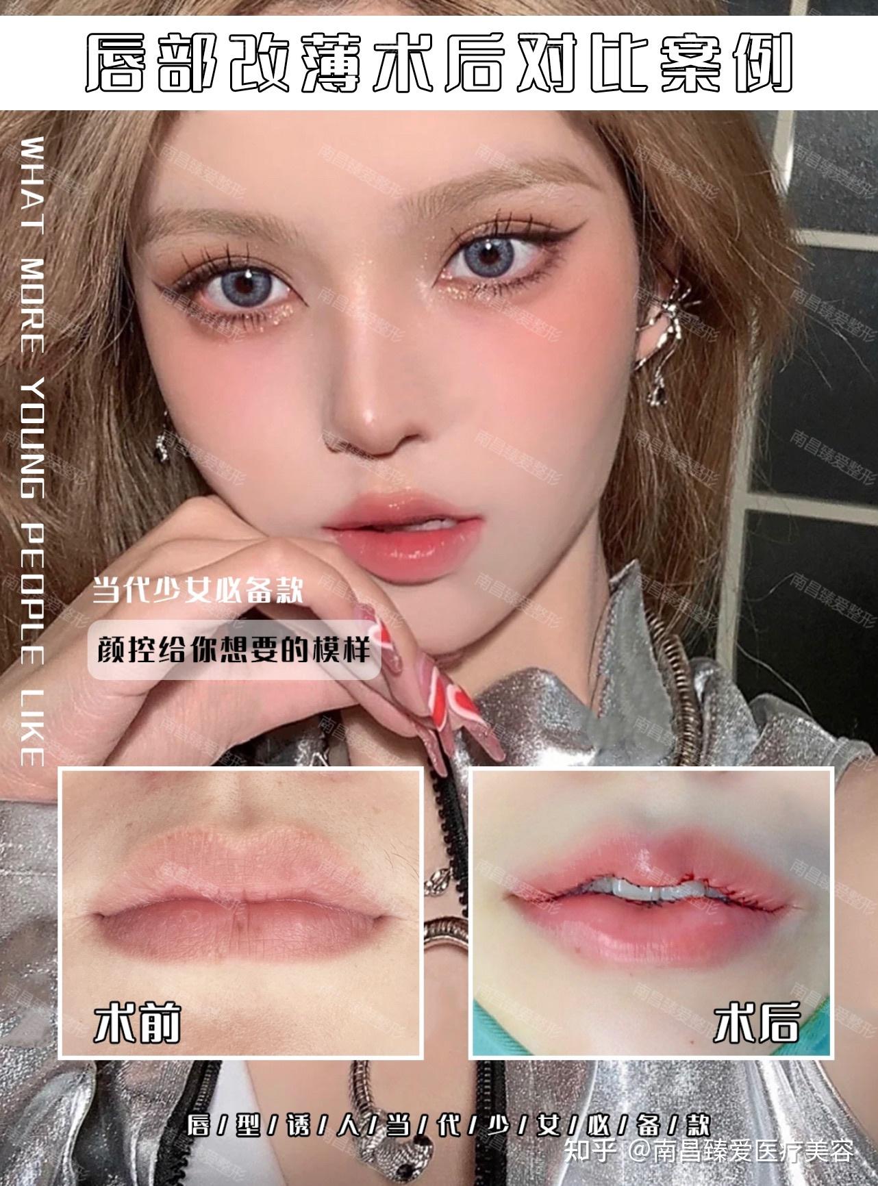 微笑唇 - 知乎