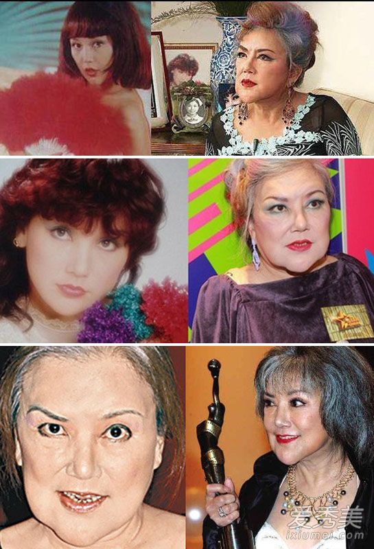 下巴整形失败的女明星