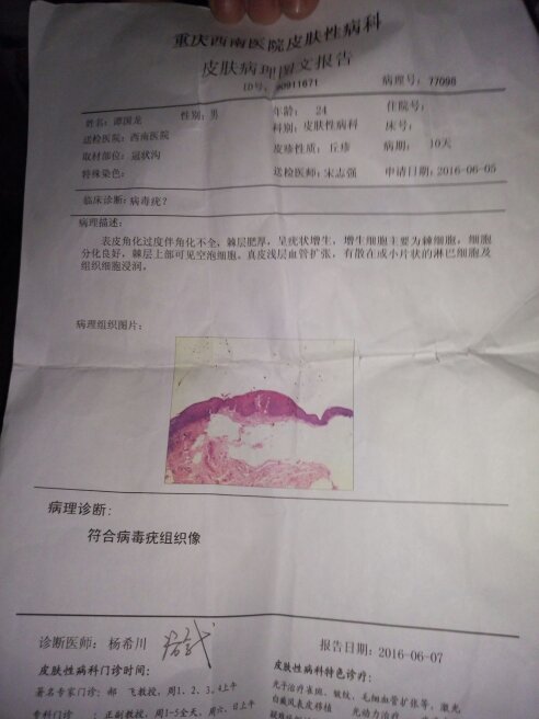 医生给的病理报告诊断说 符合病毒疣组织像,可我没有不洁性生活啊