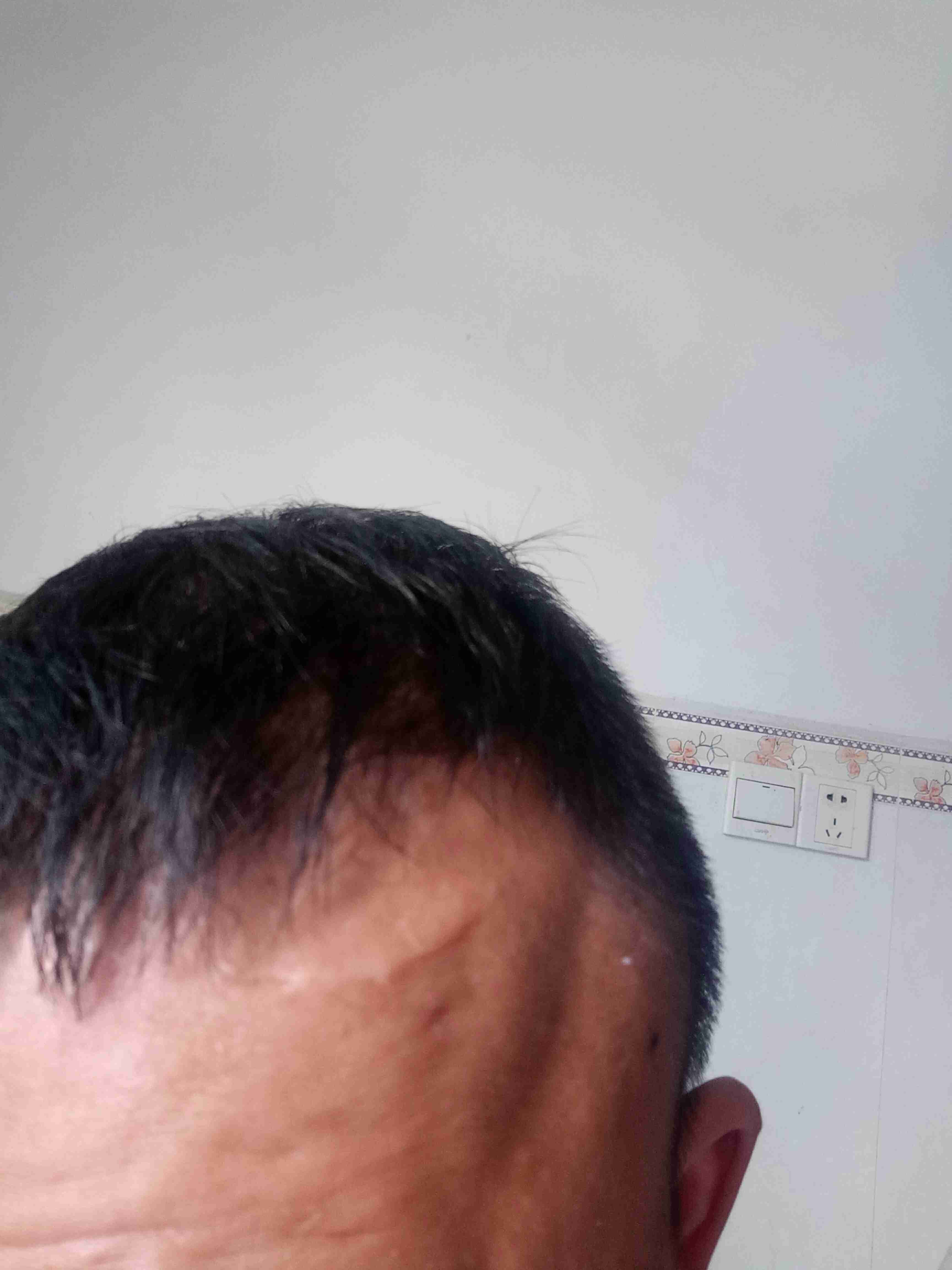 律师您好,交通事故造成我额头上有一个一寸半长的伤