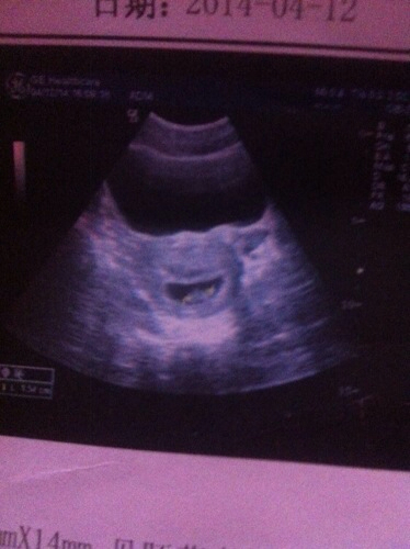 是男孩机率大还是女孩机率