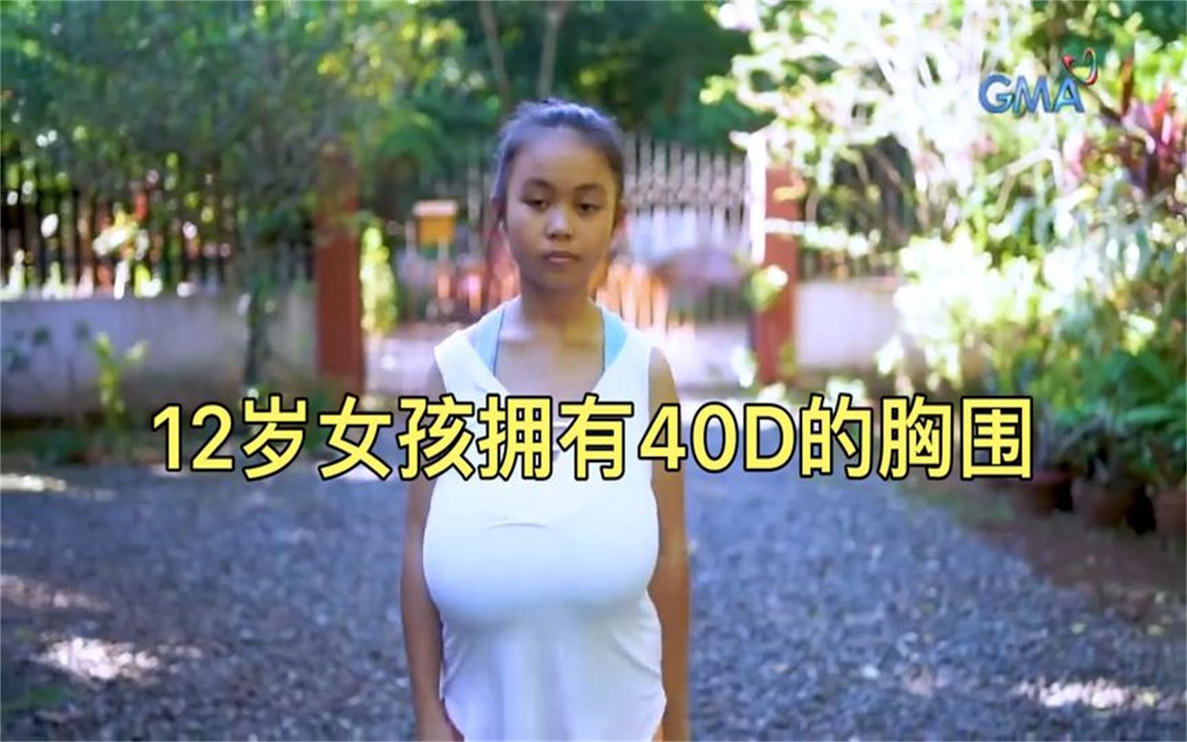 12岁的女孩拥有别人羡慕不已的胸围,却每天生活在焦虑中.