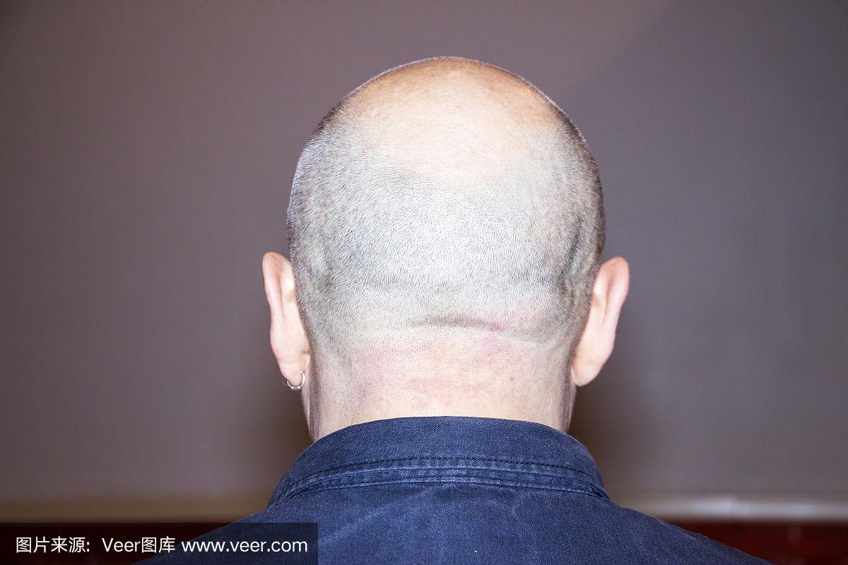 光头男人的背影