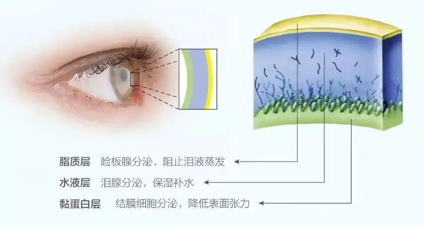 中国每5人中最少有1人患有干眼症,女性患病率25%,男性为17.