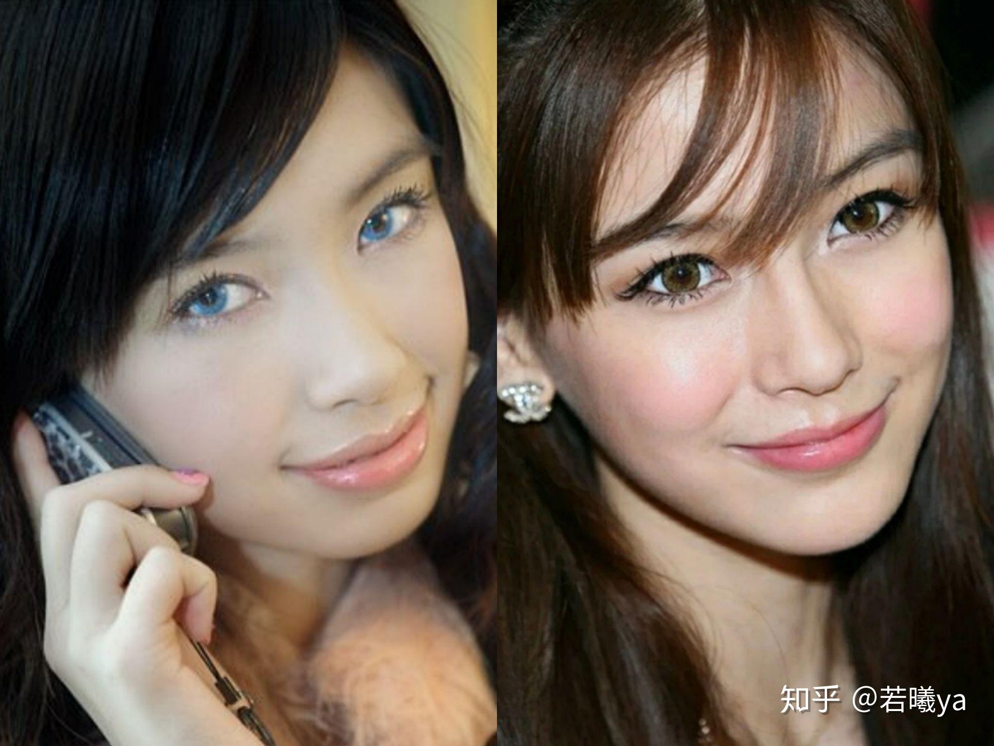 angelababy整容哪些部位? - 知乎