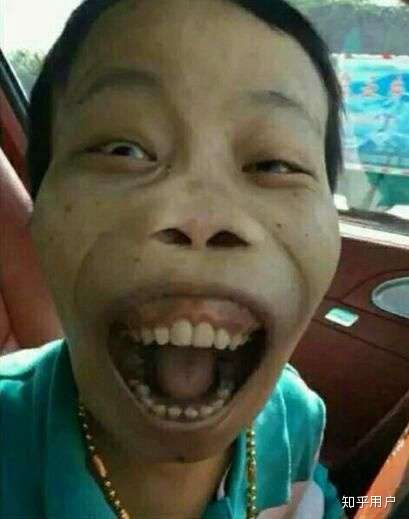 我想知道什么样算丑 ?