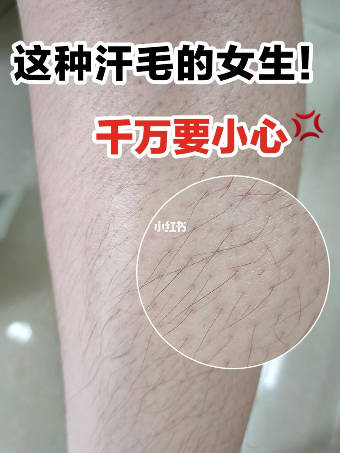 猕猴桃女生注意7215青春期脱毛93绝毛6015_脱毛_脱毛膏