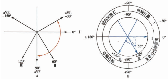 协会主张所有的计算机心电图分析程序都应使用面积法决定qrs平均电轴