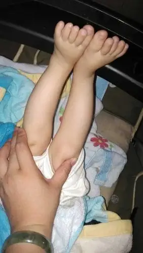 宝宝的小腿有点弯怎麼办?