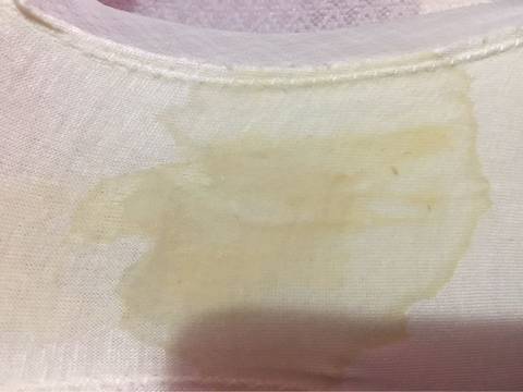 请问下各位宝妈 孕八周突然间出现图片这样子的白带 正常么?