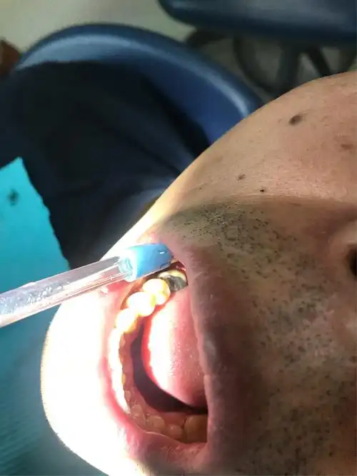 爱齿口腔,我在这里等你哦