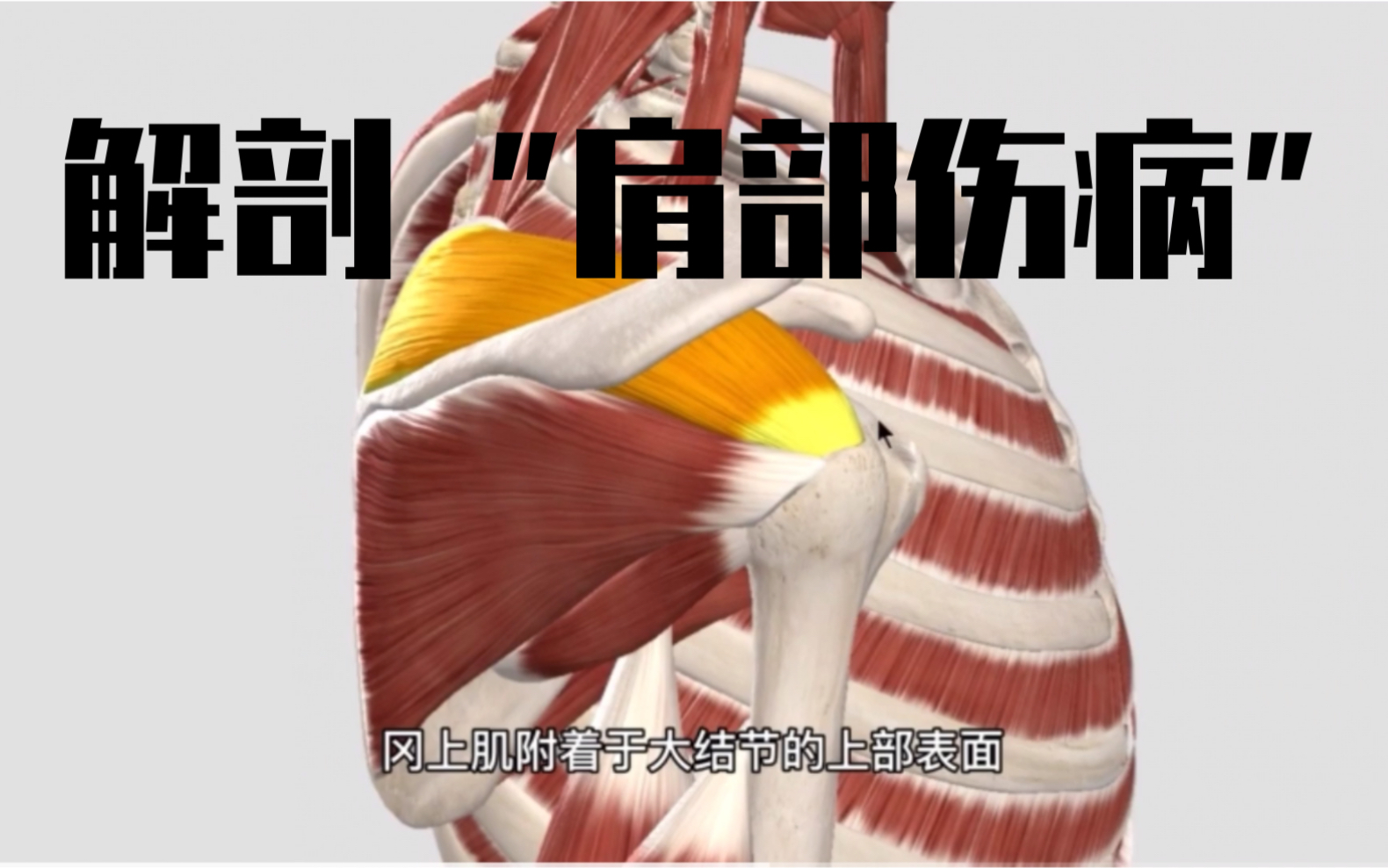 解剖肩部伤病构成原因,肩部大结节各个肌肉附着点!