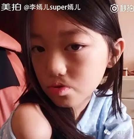 李嫣只有一颗门牙图片 李嫣上面长不出牙怎么回事