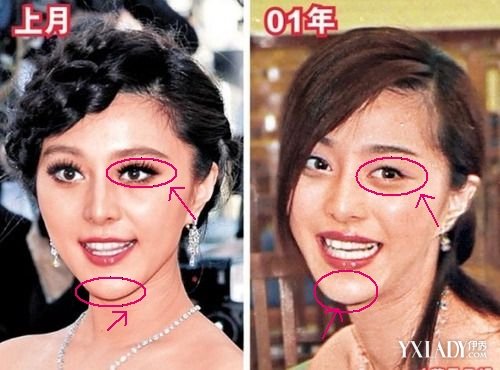 范冰冰整容前后对比 原来范冰冰也是人工美女
