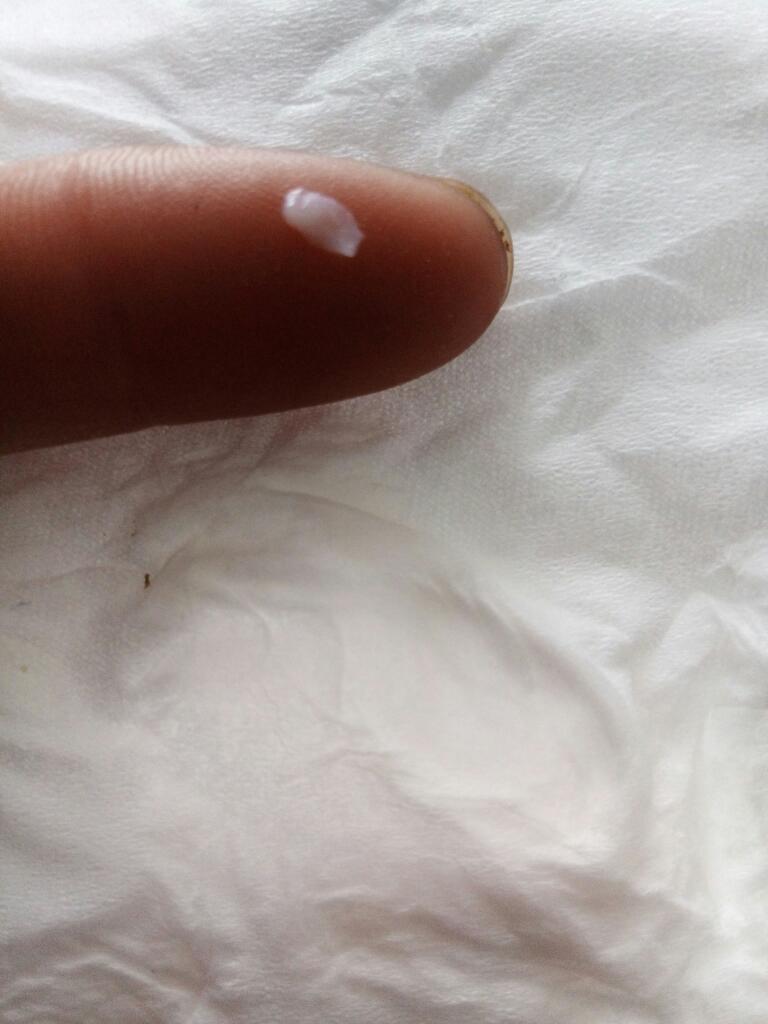 这是什么白带只看楼主