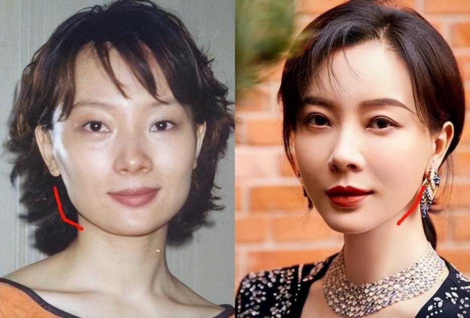 盘点娱乐圈5位整容最成功的女明星,前后判若两人,却毫无痕迹_脸部