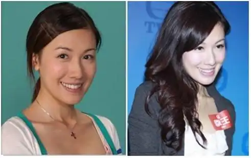 八一八tvb十大整容女明星当家花旦组图