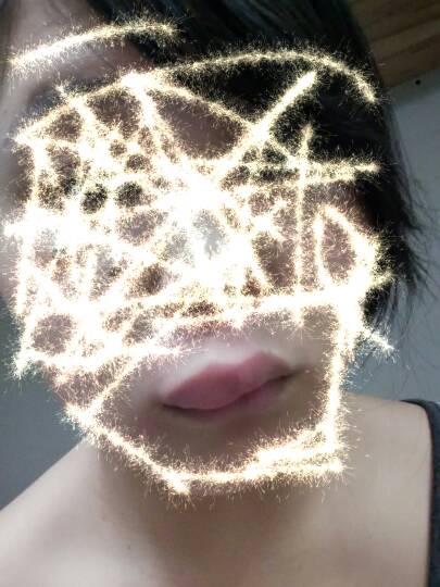 昨晚去点痣了,没打麻醉,回来后吃了份鱼蛋,过了半小时,上嘴唇就肿了一