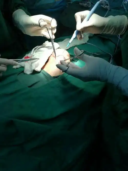 睾丸肿瘤切除术