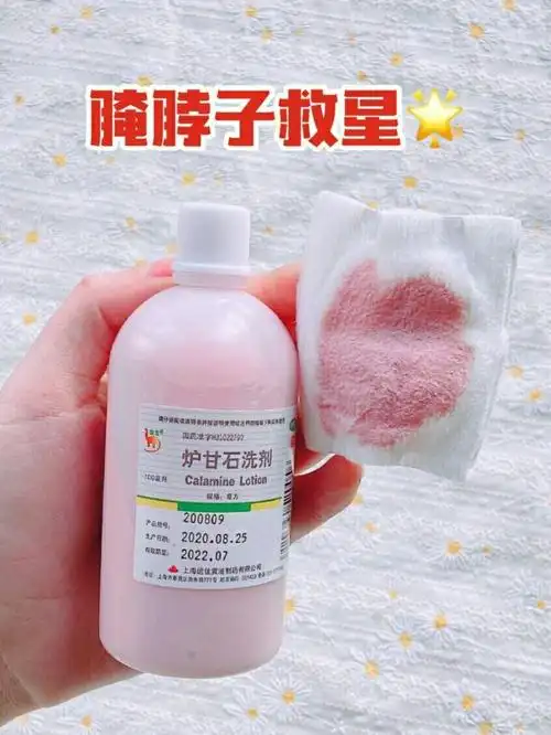 淹脖子,红屁屁,湿疹,谁用谁知道 961.炉甘石洗剂 各大药店都有