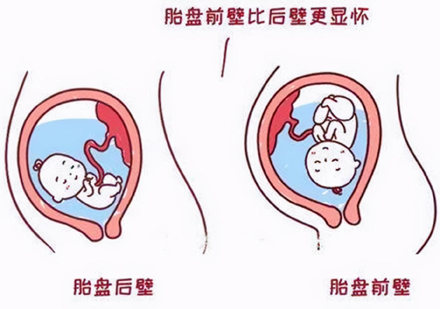 孕妈们显怀的程度,我们常见的胎盘位置只要有胎盘前壁和胎盘后壁两种