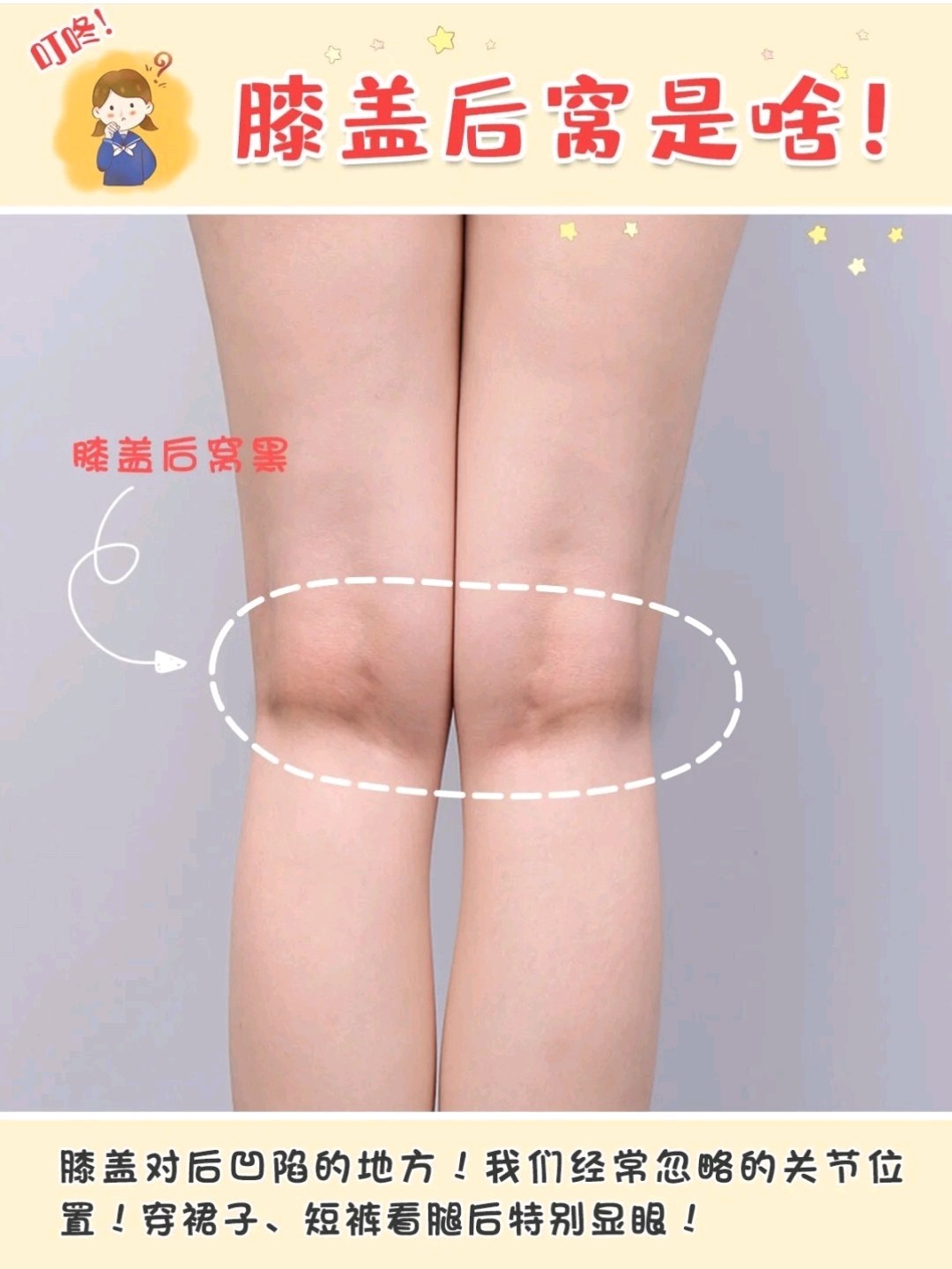 超低成本解决你膝盖后窝黑色素沉积