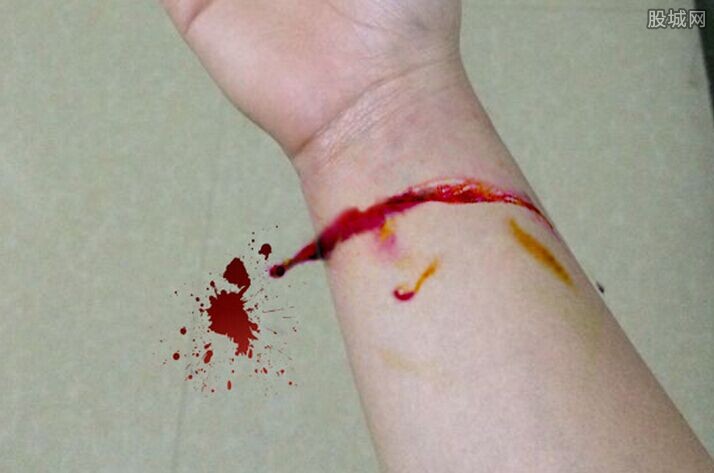 有谁能帮我把第二张图的伤口p到第一张图吗 ?谢谢